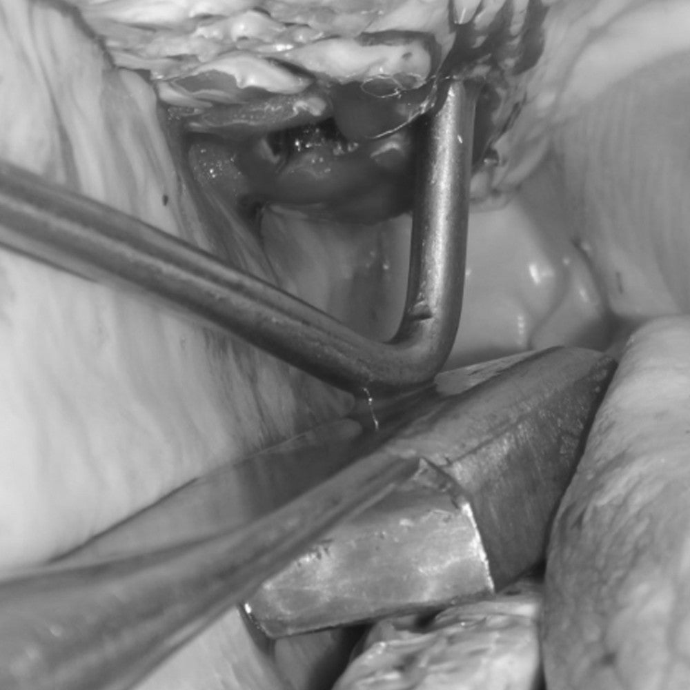 Surgical Support Kit