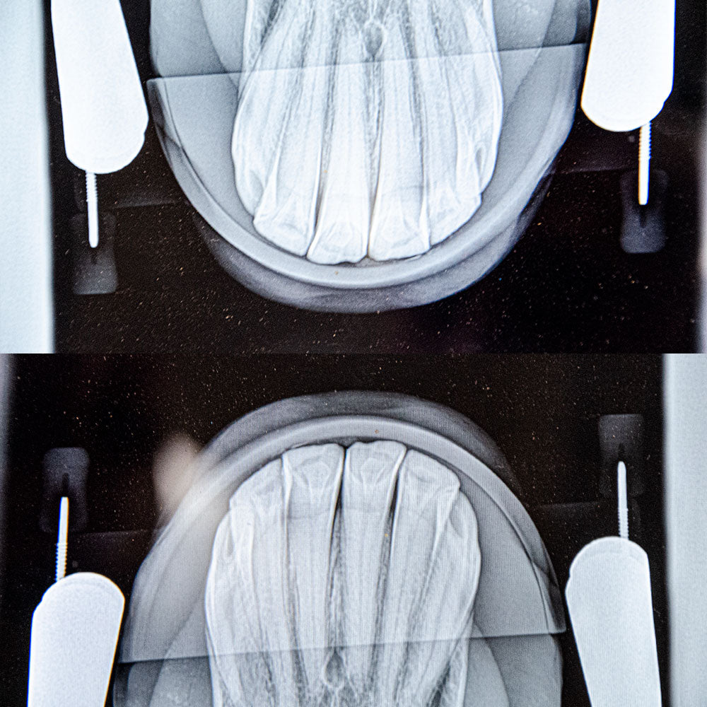 BT Radiolucent X-ray Plates